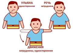 Признаки инсульта