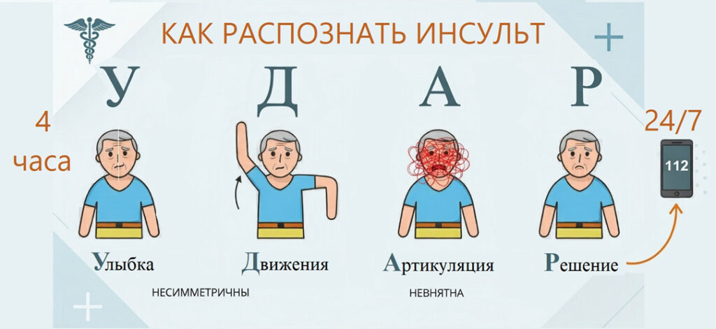 Как распознать инсульт?