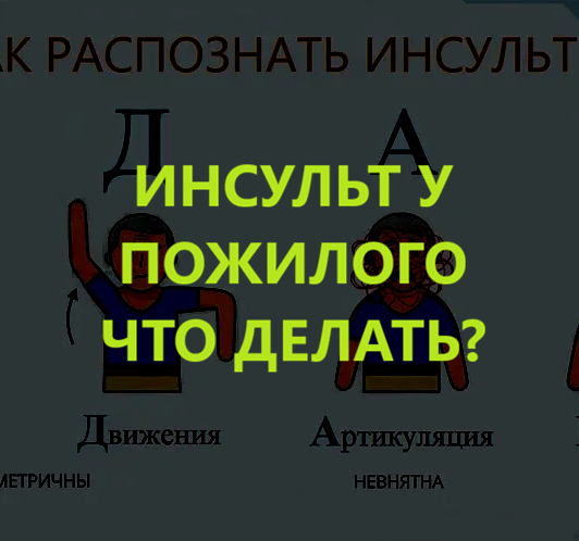 Инсульт у пожилого. Что делать?